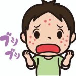 はしか　松戸
