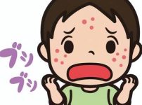 はしか　松戸